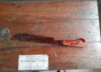 Alami Gangguan Jiwa, Pria di Malang Bacok Tangan Sendiri