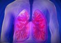 Ilustrasi penyakit tuberculosis (TBC)