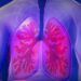 Ilustrasi penyakit tuberculosis (TBC)