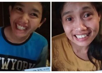 Kakak beradik di Malang yang dikabarkan terkena stroke usai melahirkan. (Foto: Instagram/vivipdharapan)