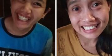 Kakak beradik di Malang yang dikabarkan terkena stroke usai melahirkan. (Foto: Instagram/vivipdharapan)