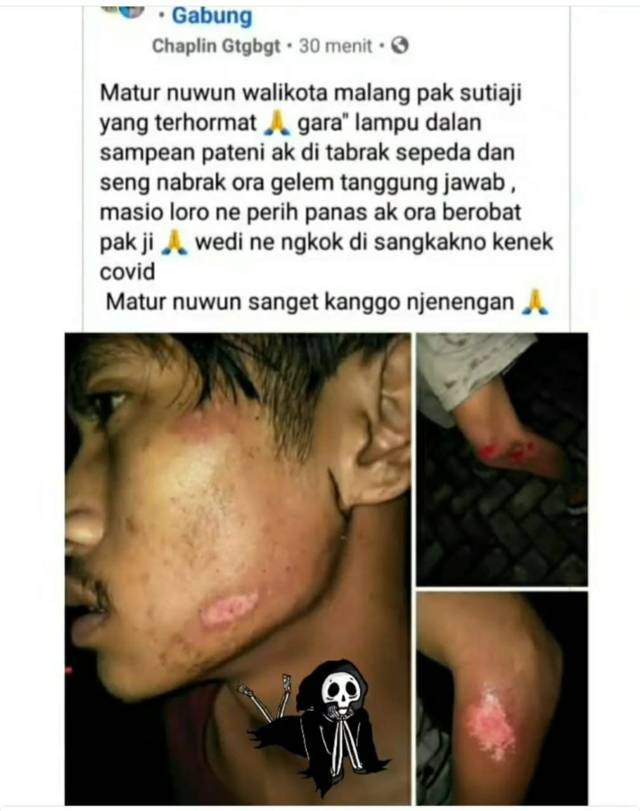 Korban laka yang diduga karena pemadaman penerangan jalan umum (PJU) di Kota Malang. (Foto: Dokumen/Tugu Jatim)