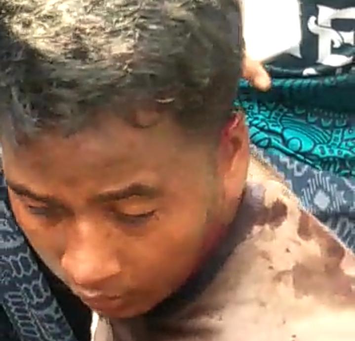 Sosok maling pria yang babak belur dihajar massa di desa Asemkandang, Kecamatan Kraton, Kabupaten Pasuruan pada Minggu (22/05/2022).