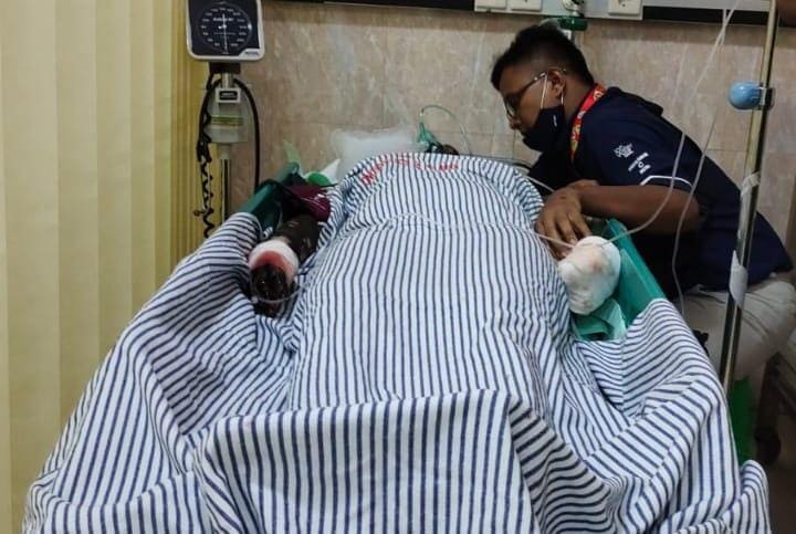 Korban ledakan bondet. (Foto: dok. Polres Pasuruan Kota/Tugu Jatim)