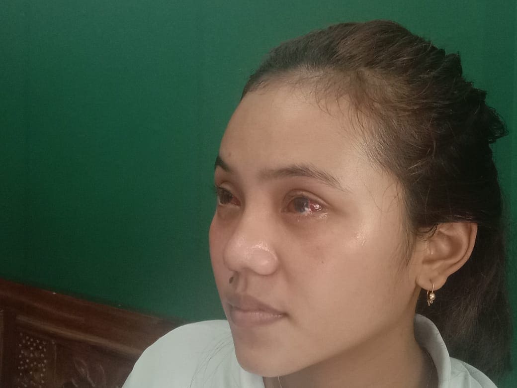 Mata memerah korban tragedi Kanjuruhan. (Foto: M. Sholeh/Tugu Malang)