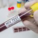 Kasus HIV/AIDS di Kota Malang Meningkat 8 hiv/aids tugu jatim