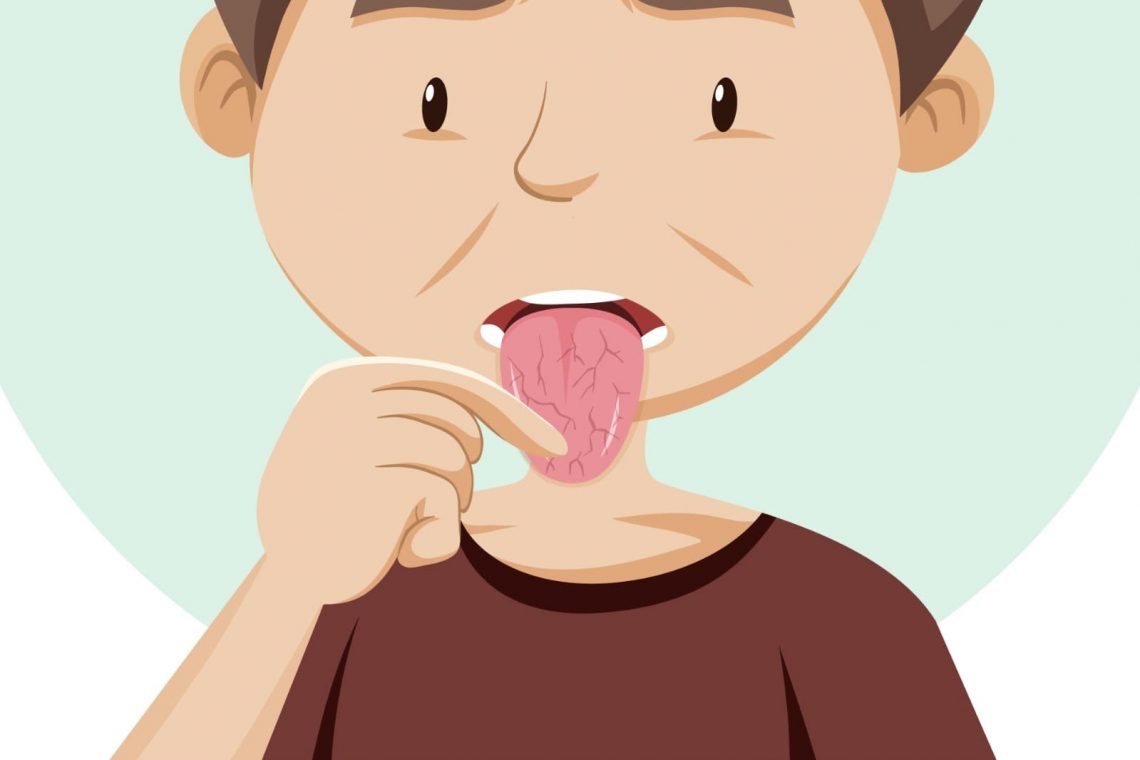 Cobain 6 Cara Mengembalikan Indera Perasa, Ampuh Cepat Atasi Dysgeusia! 1 Cara mengembalikan indera perasa.