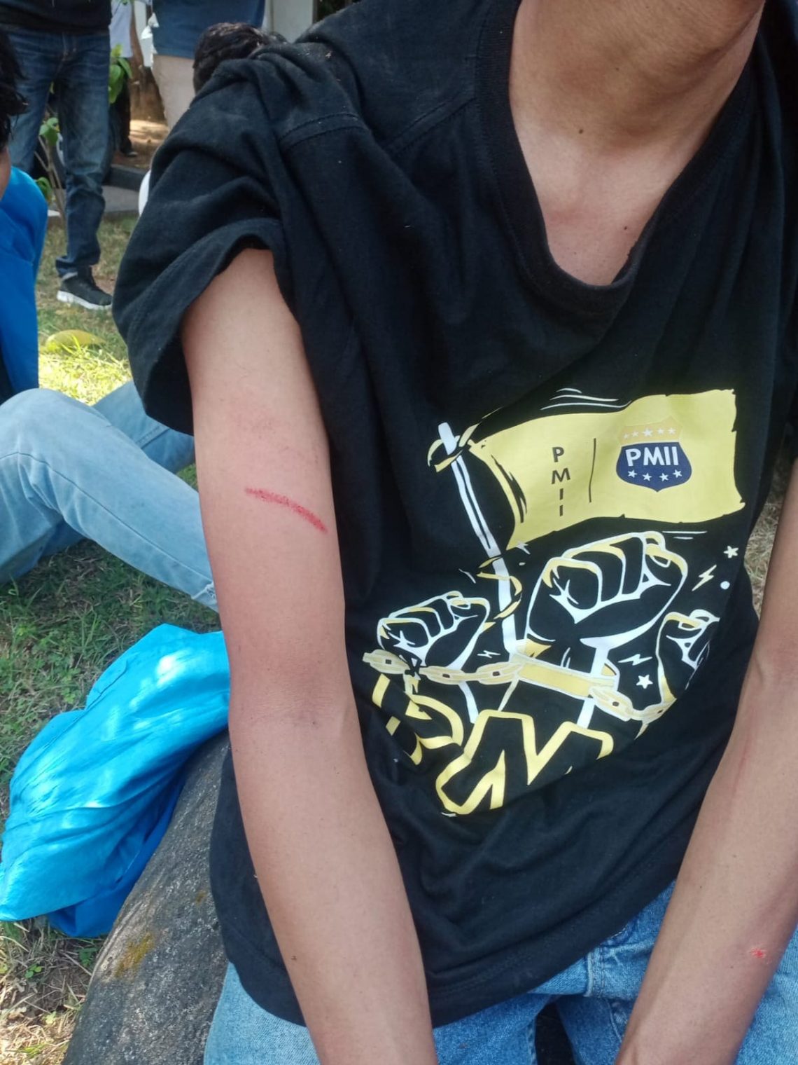 Pasca Demo Ricuh, 5 Aktivis PMII Tuban Luka Sayatan hingga Diduga Jadi Korban Pelecehan Seksual 1 Aktivis PMII Tuban.