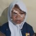 Kronologi Siswi Lawang Diduga Korban Curas Dibekap di Angkot Purwodadi Pasuruan, Alami Luka Lebam di Wajah 8 Siswi Lawang.