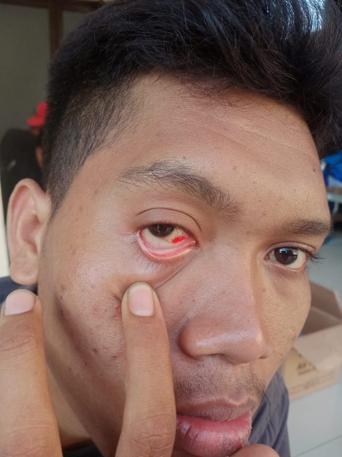 Aktivis PMII Tuban Demo Diwarnai Dugaan Pelecehan Seksual, Kapolres Sebut Hanya Senggolan Biasa 1 PMII Tuban.