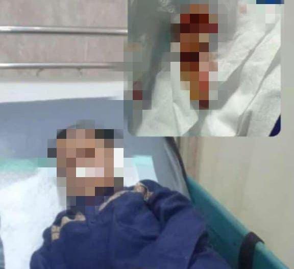 Orang Tua Bocah SMP di Bugul Kidul Pasuruan Buka Suara, Kuping Anak Digigit hingga Putus: Saya Syok, Tak Berani Lihat 1 Bocah SMP di Bugul Kidul.