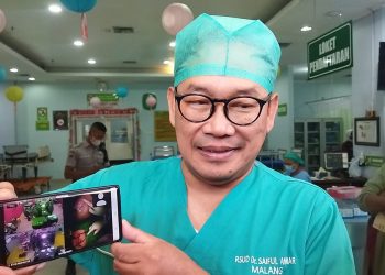 Bayi Kembar Siam di RS Saiful Anwar Malang Berhasil Terpisah
