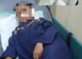 Kuping Putus Tak Bisa Disambung Lagi, Bocah SMP di Pasuruan Alami Trauma
