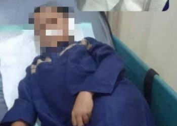 Kuping Putus Tak Bisa Disambung Lagi, Bocah SMP di Pasuruan Alami Trauma