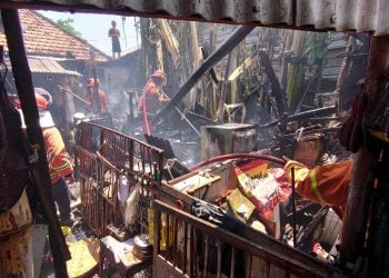 Wajah Wanita di Pasuruan Luka Bakar Saat Padamkan Kebakaran di Rumahnya