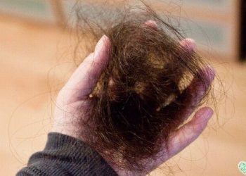 Rambut rontok.