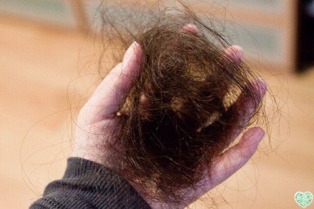 Penyebab Rambut Rontok, Inilah 5 Tips Cara Alami Mengatasinya tanpa Obat 1 Rambut rontok.