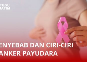 Penyebab dan Ciri-ciri Kanker Payudara, Data WHO: Diderita 2,3 Juta Orang di Dunia