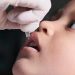 Kadinkes Jatim Ungkap 11 Anak Terinfeksi Polio, 9 Bocah tanpa Gejala 9 Terinfeksi polio.