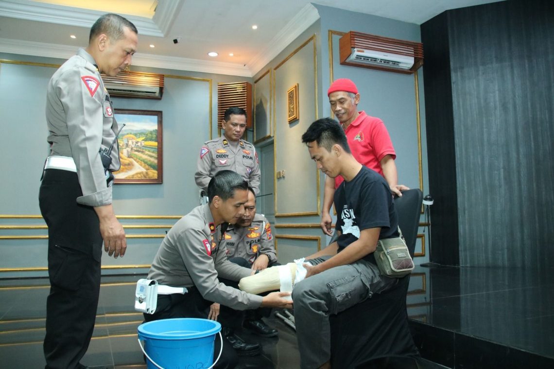 Hari Bhayangkara Ke-78, Polresta Malang Kota Gandeng Kick Andy Foundation Bantu Kaki Palsu Para Penyandang Disabilitas 1 Kaki Palsu