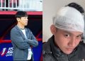 Timnas Indonesia vs Guinea: Shin Tae-yong Diganjar Kartu Merah, Witan Sulaeman Alami Luka 5 Jahitan 11 Shin Tae-yong