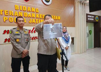 Hasil Identifikasi Sementara Penemuan Kerangka Manusia di Rumah Pompa Surabaya, Diduga Berjenis Perempuan 1 Kerangka manusia.