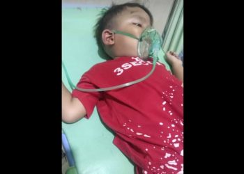 Bocah di Jember Viral Naik Sepeda Listrik hingga Pendarahan, Dugaan Disenggol Mobil Pickup: Sopir Kabur 
