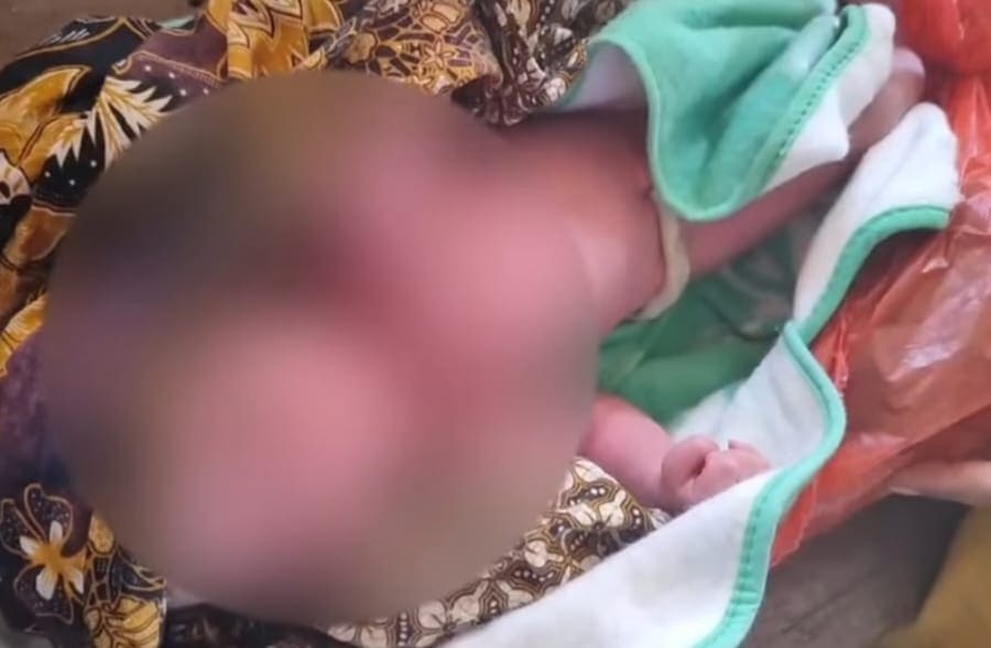 Bayi Laki-Laki Terbungkus Kresek Merah di Surabaya Diduga Dibuang, Polisi: Tak Ada Surat, Hanya Berselimut Kain Jarik 1 Bayi laki-laki.