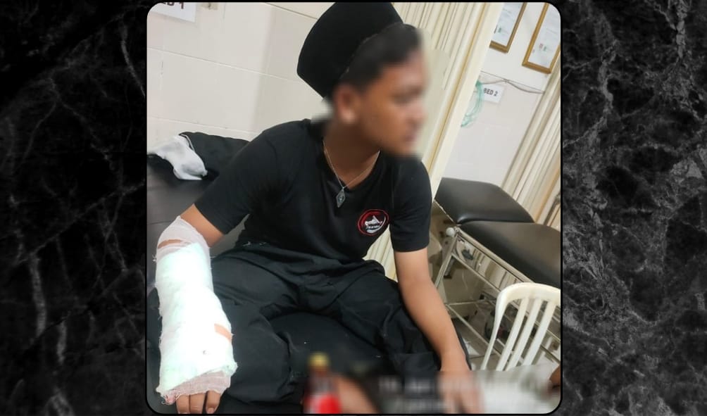 Pelajar SMP di Pasuruan Luka Robek Setelah Dikeroyok Gerombolan Gang Motor 1 Pelajar di Pasuruan