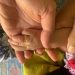 Pemadam Kebakaran Tuban Buka Cincin di Jari Bayi yang Makin Bengkak Karena Terjepit 8 Cincin Bayi