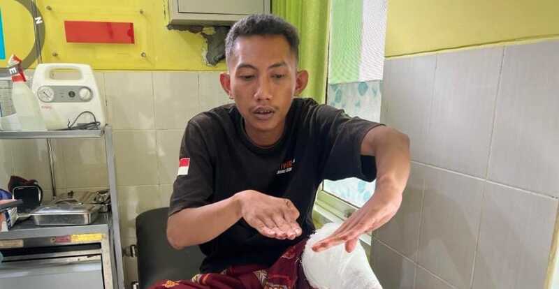 Usai COD HP, Warga Kejayan Dibacok Begal Pasuruan, Motor Dirampas 1 Begal Pasuruan.