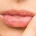 Bibir Kering dan Pecah-Pecah