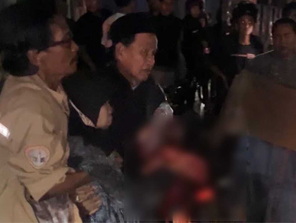 Kecelakaan Tragis di Jalur Pantura Probolinggo, Kaki Pemotor Putus Terlindas Truk Semen 1 Jalur Pantura Probolinggo.