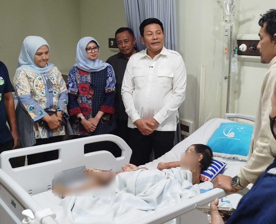 Terharu! Bocah Usia 7 Tahun Luka Bakar 46 Persen, Bupati Sidoarjo Subandi Siapkan Pengobatan hingga Pekerjaan untuk sang Ayah 1 Bupati Sidoarjo.